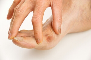 Can Yoga Help Bunions?