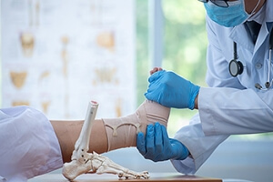 Ankle Fractures