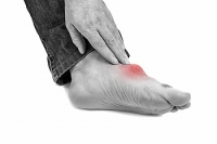 How Uric Acid Causes Gout