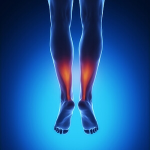 Ways to Help Prevent an Achilles Tendon Injury