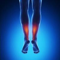 Ways to Help Prevent an Achilles Tendon Injury